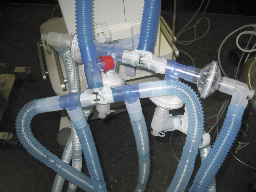 Can 1 Ventilator Treat 2 Patients? American Council on Science and Health